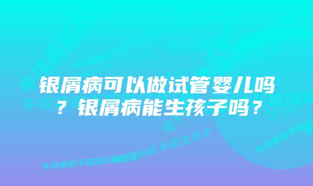 银屑病可以做试管婴儿吗？银屑病能生孩子吗？