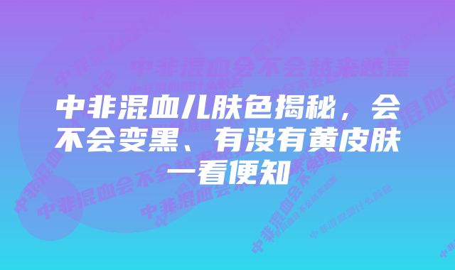 中非混血儿肤色揭秘，会不会变黑、有没有黄皮肤一看便知