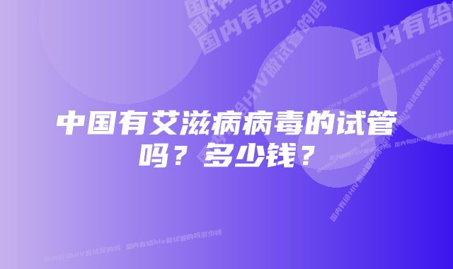 中国有艾滋病病毒的试管吗？多少钱？