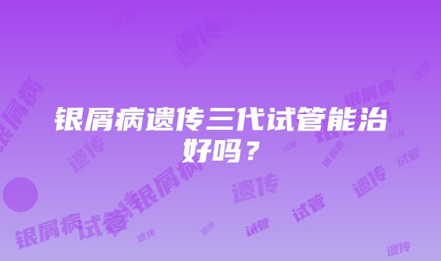 银屑病遗传三代试管能治好吗？