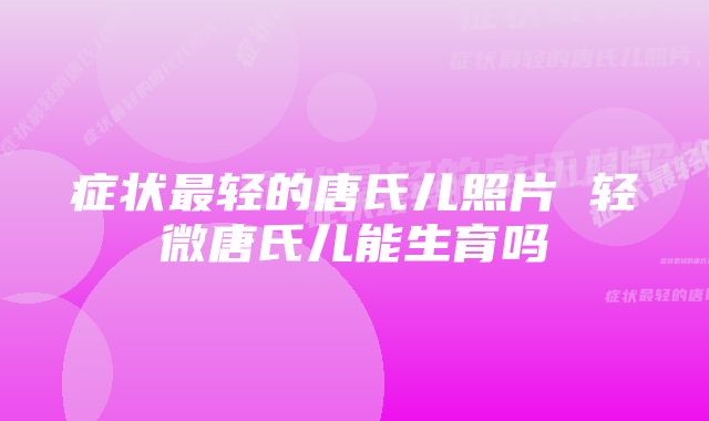 症状最轻的唐氏儿照片 轻微唐氏儿能生育吗