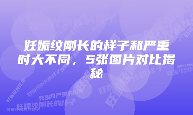 妊娠纹刚长的样子和严重时大不同，5张图片对比揭秘