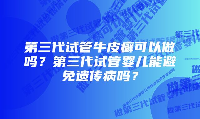 第三代试管牛皮癣可以做吗？第三代试管婴儿能避免遗传病吗？